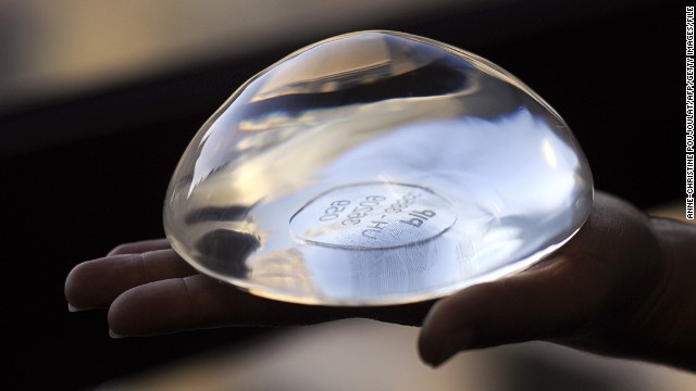 French court orders damages for victims of breast implant scandal