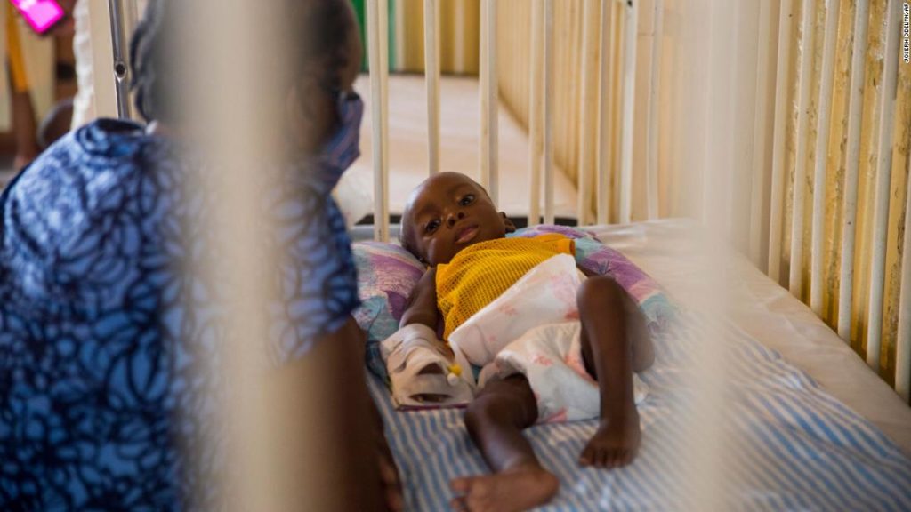 In Haiti, child malnutrition is spiking amid pandemic, says UNICEF